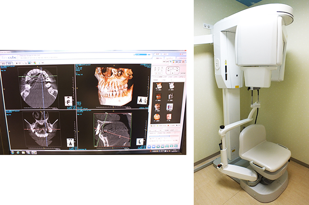 歯科用CT