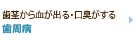 歯茎から血が出る・口臭がする 歯周病