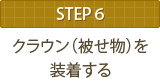 STEP6 クラウン（被せ物）を装着する