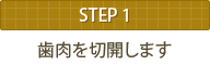 STEP1 歯肉を切開します