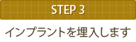STEP3 インプラントを埋入します
