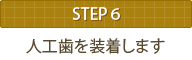STEP6 人工歯を装着します